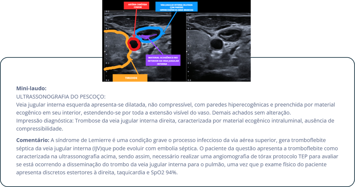 Exemplo de imagem radiológica